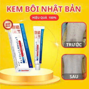 Kem Bôi Viêm Da Cơ Địa NHẬT BẢN Lác Đồng Tiền Nấm Da Đầu Ghẻ Nước Á Sừng An Toàn Hiệu Quả