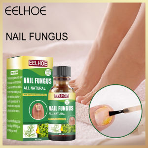 Eelhoe Fungal Nail Treatment Oil Nail Treatment Care Tea Tree Oil Nail Treatment Essence Fungal Nail Fungus Treatment Essence Anti Infective Paronychia Onychomycosis Toe Care Repair Serum Foot Nail Fungus Repair Gel Foot Care Solution（30ml）