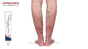 🌿 Jemeesen Vein Relief Cream – Soothes Discomfort Reduces Spider Veins & Swelling  Promote Leg Circulation  Herbal Formula for Daily Use