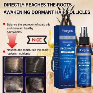 Smooth Moisturizing Essence Spray Hair Growth Hair Growth Spray Hair Loss Treatment  Scalp Treatment  For Thinning Hair  Scalp Stimulating Serum For Hair Follicles Anti Hair Loss Treatment Spray Thicker Fuller Hair Growth
