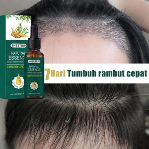 SWEETRIPGinger King Serum Anti Botak Rambut Lebat Sehat BErkilau-Penumbuh Rambut Secara Cepat/Penyubur Rambut Rontok Pria- PELEBAT RAMBUT - PENUMBUH RAMBUT BERKHASIAT - MENGHITAMKAN RAMBUT- PENUMBUH RAMBUT MANJUR