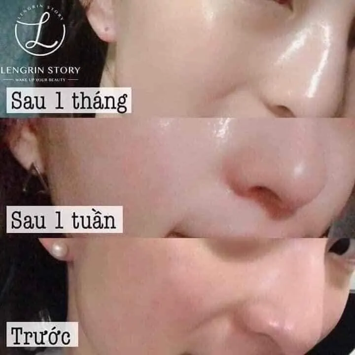 SERUM%20CIRACLE%20HYDRA%20B5%20SOURCE%20-%20d%C3%A0nh%20cho%20da%20m%E1%BB%A5n%20v%C3%A0%20%C4%91ang%20b%E1%BB%8B%20t%E1%BB%95n%20th%C6%B0%C6%A1ng%20-%20Image%206