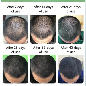 Herbal Hair Oil Cleanses Scalp Smoothes Hair Prevents Hair Loss Strengthens Hair Repair Oil