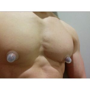 ทรีทเมนต์หัวนม ช่วยให้เต่งตึง ทําจากซิลิโคน Breast Cup แก้หัวนมบอด หัวนมสั้น แพค 2 ชิ้น