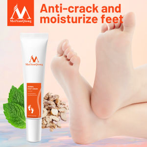 MeiYanQiong FDA ครีมบำรุงเล็บ น้ำยาล้างหนังกำพร้า ไวท์เทนนิ่ง ที่ทาเล็บ เท้าเชื้อรา ดูแลเล็บ ราคาถูก Herb Anti-Fungal Beriberi Cream