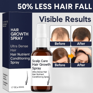 Hair Growth Spray Anti Hair Loss Fast Growing Hair Nutrient Conditioning Serum Natural Anti Hair Loss Products