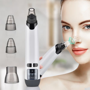 Electric Blackhead Remover Pore Vacuum Cleaner Comedone Acne Pimple Extractor Tool 3 Adjustable Suction Levels 4 Replaceable Suction Heads USB Rechargeable