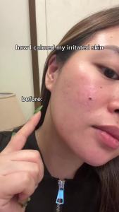 ROUND LAB Pine Calming Cica Ampoule 1.01 Fl Oz Hydrating and Soothing Serum with Pine Cica and Hyaluronic Acid for Skin Barrier Strengthening Gentle Exfoliation and Deep Moisture Korean Skincare    Hydrating and Soothing Serum Pine Cica and Hyaluron