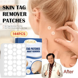 EELHOE Skin Tag Removal Patches Fast-Acting Skin Tags Remover Patches Invisible Remover Patches for Any Skin Type Double Sided Treatment Face Skin Tag Removal Tool Acne Tag Remover Face Skin Tag Removal Patch