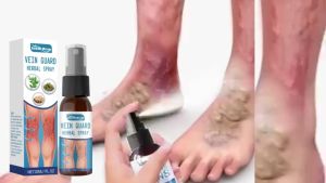 Limited Offer Varicose Vein Spray 30ml For Leg Fatigue Relief Soothes Vasculitis & Phlebitis Natural Herbal Formula Fast Absorbing Non-Greasy Daily Leg Care Special Offer