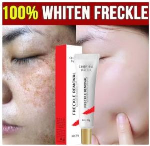 White Cream freackles FA