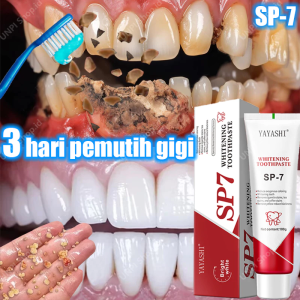 Pasta gigi SP7 odol pemutih gigi dan karang gigi Rrobiotic Whitening Toothpaste Perawatan Mulut Menyegarkan untuk Gigi Bersih Cocok