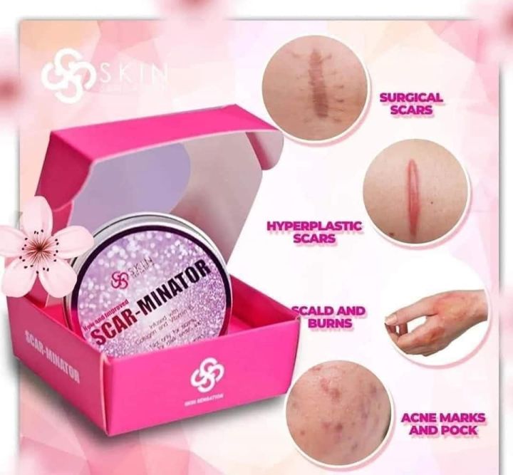 Skin Sensation Scarminator Cream 40ml Scar Remover / Minimizer Whitening w/ Vitamin E