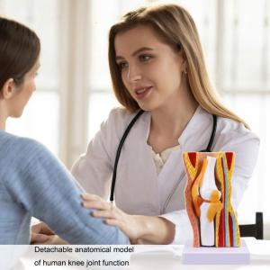 Human Knee Joint Anatomy Model Teaching Tool Human Knee Joint Model Teaching Supplies for Science Education