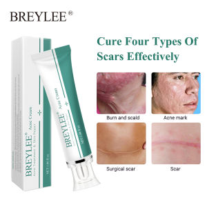 BREYLEE Scar Removal Cream 30g Acne Scar Remover Anti Acne Repair Strech Marks Pimple Marks Acne Treatment Skin Care