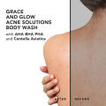 Grace and Glow Brightening Solution + English Pear and Freesia Anti Acne Solution Body Wash. 