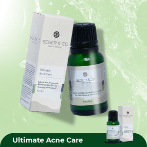 Seger & Co Ultimate Acne Care Halal BPOM 15ml Niacinamide Treatment Hilangkan Jerawat
