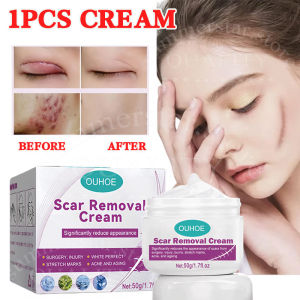 Original Scars Remover Cream Scar Repair Cream Anti-Stretch Mark Cream Intensive Skin Treatment for Improvement and Elimination of Stretch Mark Appearances Original Anti-Stretch Mark Cellulite Remover Anti Scar Cream Firming Skin Cream Peklat Remover