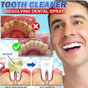 Dental Calculus Dissolving Deodorant Spray Tartar Removal Oral Spray Eliminates Bad Breath