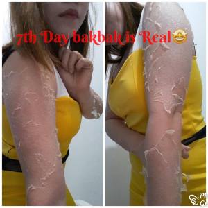 SCD Peeling Lotion Large (100ml) w/ FREEBIES (New Packaging 2025)