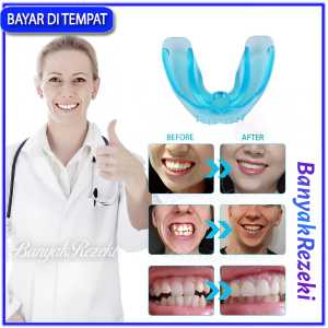 PALING AMPUH MERAPIHKAN GIGI Perapih gigi tonggos atas bawah Perata gigi tonggos atas bawah Behel perapih gigi tonggos lepas pasang Alat perata gigi tonggos atas Perapih gigi maju ke depan mundur Alat pemundur gigi tonggos ampuh ori Orthodontic Retainer T