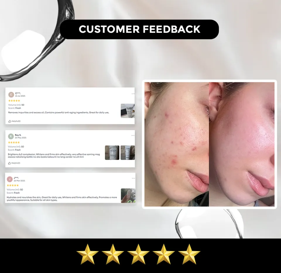 glutathione users feedback  Friday  We're loving the results from Simplee S-Acetyl Glutathione!  From a glowing complexion to feeling lighter and more energized, our customers are experiencing the full transformation. It's more VERA FILES FACT CHECK: Doc