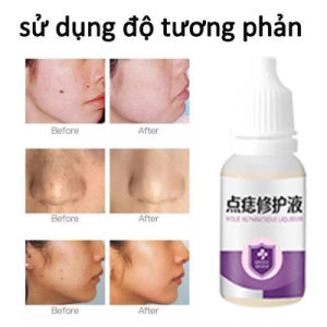 Serum mục cóc chấm mụn cóc loại bỏ mụn cơm