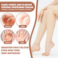 Eelhoe Strong Effective Dark Knuckles Remover Serum Powerful Whitening Cream Hand Knuckle Cream For Elbow And Knee Black Skin Dark Feet Whitening Cream Fast Whitening Cream For Dark Feet Dark Knees And Elbows Strong Whitening Cream 50g. 