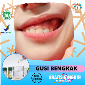 Obat Gusi Bengkak Sakit Gigi Dan Gusi Bengkak Gusi Berdarah Gusi Bernanah Gusi Membengkak Obat Tetes Nyeri Gusi Ngilu Nyut Nyutan Abses Gusi Benjolan Di Gusi Atas Bawah Untuk Anak Dan Dewasa - Propolis Sm 100% Heerbal