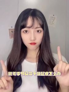 Vitex Moisturizing Amide Body Lotion Hydrating Moisturizing Long-lasting Fragrance Skin Softening Refreshing Fruit Acid Body Lotion Wholesale