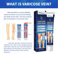 South Moon Venous Massage Varicose Cream Relieve Leg Vascular Protrusion Choroid Varicose Earthworm Leg Repair Varicose Veins Cream Vasculitis Phlebitis Spider Pain Relief Plaster Earthworm Leg Treatment Ointment Body Care. 