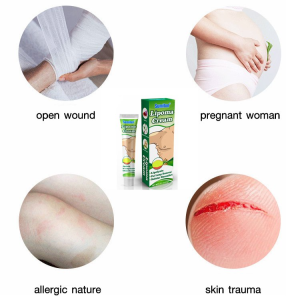 X22033101FA Lipoma Relief Ointment for All Seasons Adult Women and Men  Alleviates Skin Swelling Discomfort with Continuous Use for Lipoma Patients