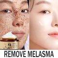 30g Whitening melasma cream Freckle Removing Cream pekas cream original japan  Remove Wrinkles Cream Pekas Remover Cream Blemish Cream Remove Melasma Freckles Anti Aging Serum Sunburn remove dark spot on face pikas remover cream Moisturizing Cream. 