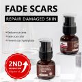 VIBRANT GLAMOUR Crocodile Scar Repair Toner Fade Scar Prevent Scar Hyperplasia Sensitive Skin Deep Care. 