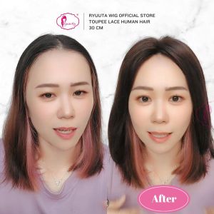 Ryuuta Wig Toupee Topper Lace Human Hair Rambut Asli 30 cm