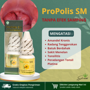 Obat Amandel Kronis Radang Tenggorokan Batuk Berdahak Sakit Menelan Tonsilitis Peradangan Tonsil Platina Terbukti AMAN