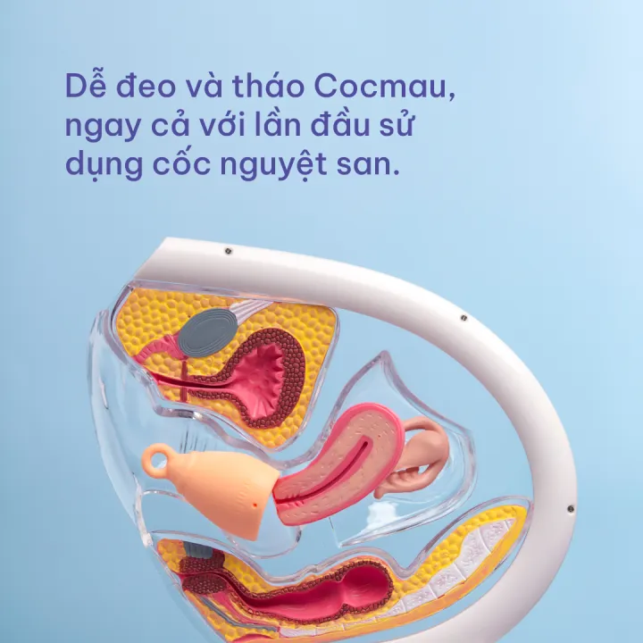Cốc nguyệt san cải tiến Cocmau - Dành cho cơ địa Á châu - Thiết kế cho lần đầu - Dung tích x2 BVS - 24ml