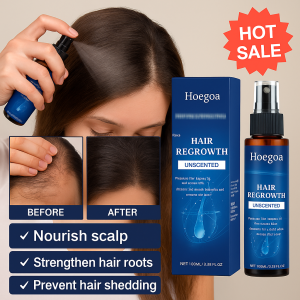 【Effective Hair Growth】Hair Growth Spray Hair Care Essence Spray/ Improve Hair Follicle Hair Growth Spray Anti-hair Loss Spray Scalp Care Products Natural Plant Ingredients