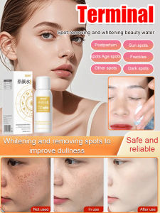 Anti-Freckle Whitening Spray Lightening Melanin Hydrating Moisturizing Whitening Brightening Blemish Spray Blemish Removal Anti-Wrinkle And Whitening Essence Water Melasma Removal Bleaching Cream Brightening Blemish Control M