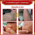 vivistyle ยาทากำจัดเนื้องอกไขมัน (กำจัดเนื้องอกไขมันใน 7 วัน). 
