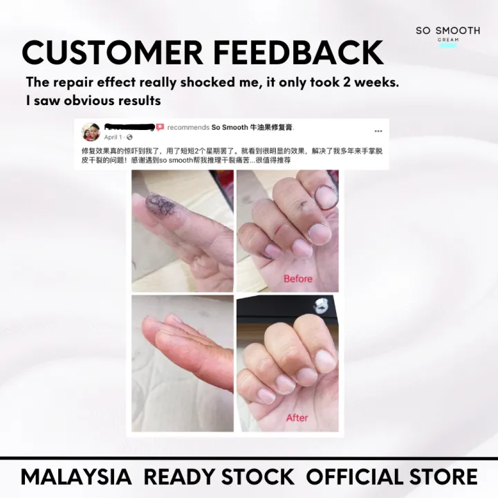 【SO SMOOTH】SSC Leg and Hand Moisturizing Cream 50g | Lazada
