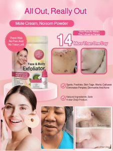 Skin Mole And Wart Remover/Acne Care Kit/Skin Care Body Care Set/Soothing Skin Care/Family Use For Men And Women