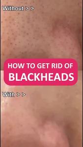 Carrotene IPMP Hydromelt Cleansing Balm  Make Up Remover  Sebum  Blemish  Blackhead