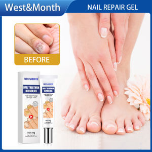 West Month Nail Treatment Repair Gel Nail Treatment Essence Fungal Nail Treatment Serum Nail Care Cream Nail Fungal Treatment Nail Foot Nail Fungus Removal Gel Anti Infection Onychomycosis Nail Repair Essence Cream Feet Care(20g)