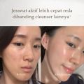GBELLE Face Wash 3in1 Acne Moisturizing Brightening Cleansing Mousse 150m Pembersih Wajah Mencerahkan Facial Wash Massage Kulit Berjerawat Iritasi Kemerahan G-Belle. 