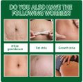 Vova Strechmark cream krim penghilang stretchmark stretchmark selulit. 