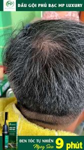 Dầu gội phủ bạc nano MP LUXURY thuốc nhuộm tóc công nghệ Nhật bản