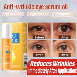 Lutein Eye Essence Oil With Rolling Effectively Lightens Dark Circles  Fine Lines Relieves Fatigue VC Eye Oil