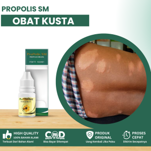 Obat Penyakit Kusta Obat Penyakit Kusta Kering Dan Basah Obat Bercak Putih Di Kulit Obat Kusta Di Badan Obat Bercak Kulit Hitam Merah Infeksi Jamur Kulit Dengn Propolis SM