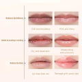Lip Serum with Roll-On Lip Balm Moisturizes And Reduces Lip Lines Protects Dry Chapped & Dark. 